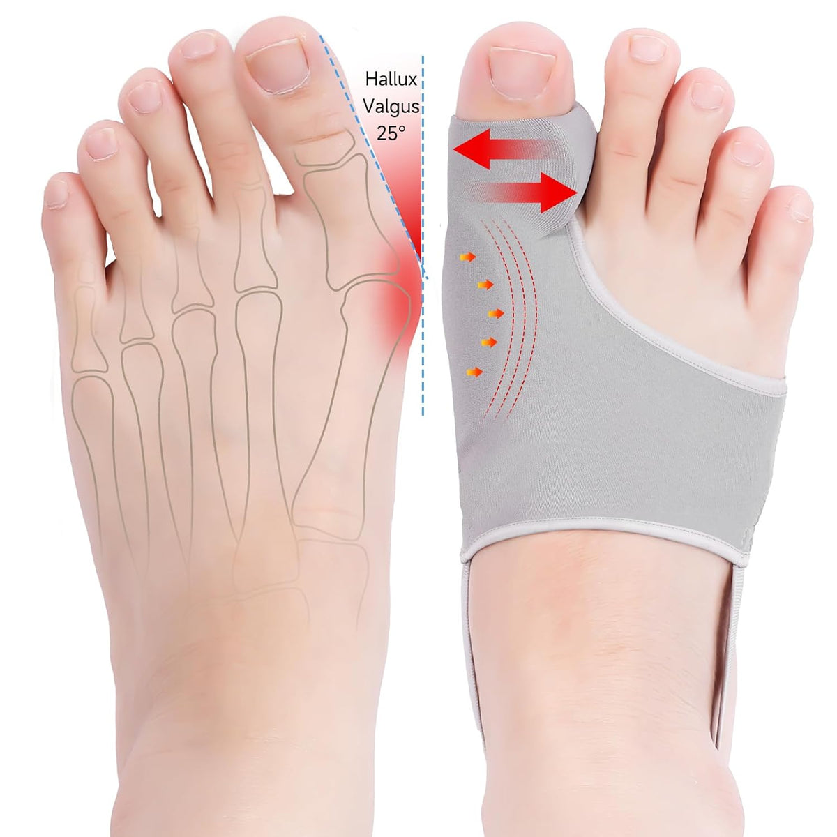 HYGGEAR BIG TOE BUNION [HALLUX VALGUS] CORRECTOR: SPECIAL BUNDLE OFFER