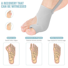 HYGGEAR BIG TOE BUNION [HALLUX VALGUS] CORRECTOR: SPECIAL BUNDLE OFFER